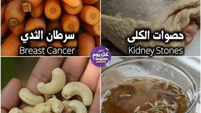 معلومات طبية