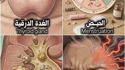 الصداع وطرق علاجه