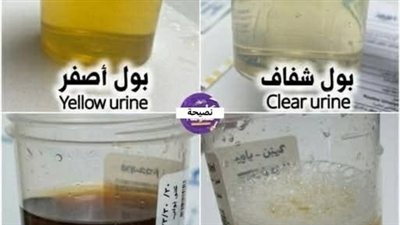 بول شفاف : كثرة شرب..