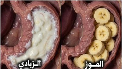 الزبادي : يدعم البكتيريا..