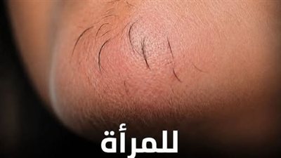 اذا كنتِ امرأة تعاني من شعر الذقن انتبهي أليكِ ما يعتيه هذا وكما احضرنا لك اسرع طـريقة للتخلـص منه نهـائي