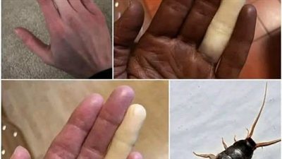 احذر مليون مرة قبل ملامسة هذه الحشره