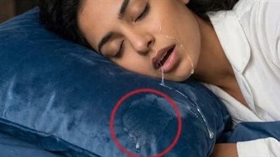 سيلان اللعاب أثناء النوم